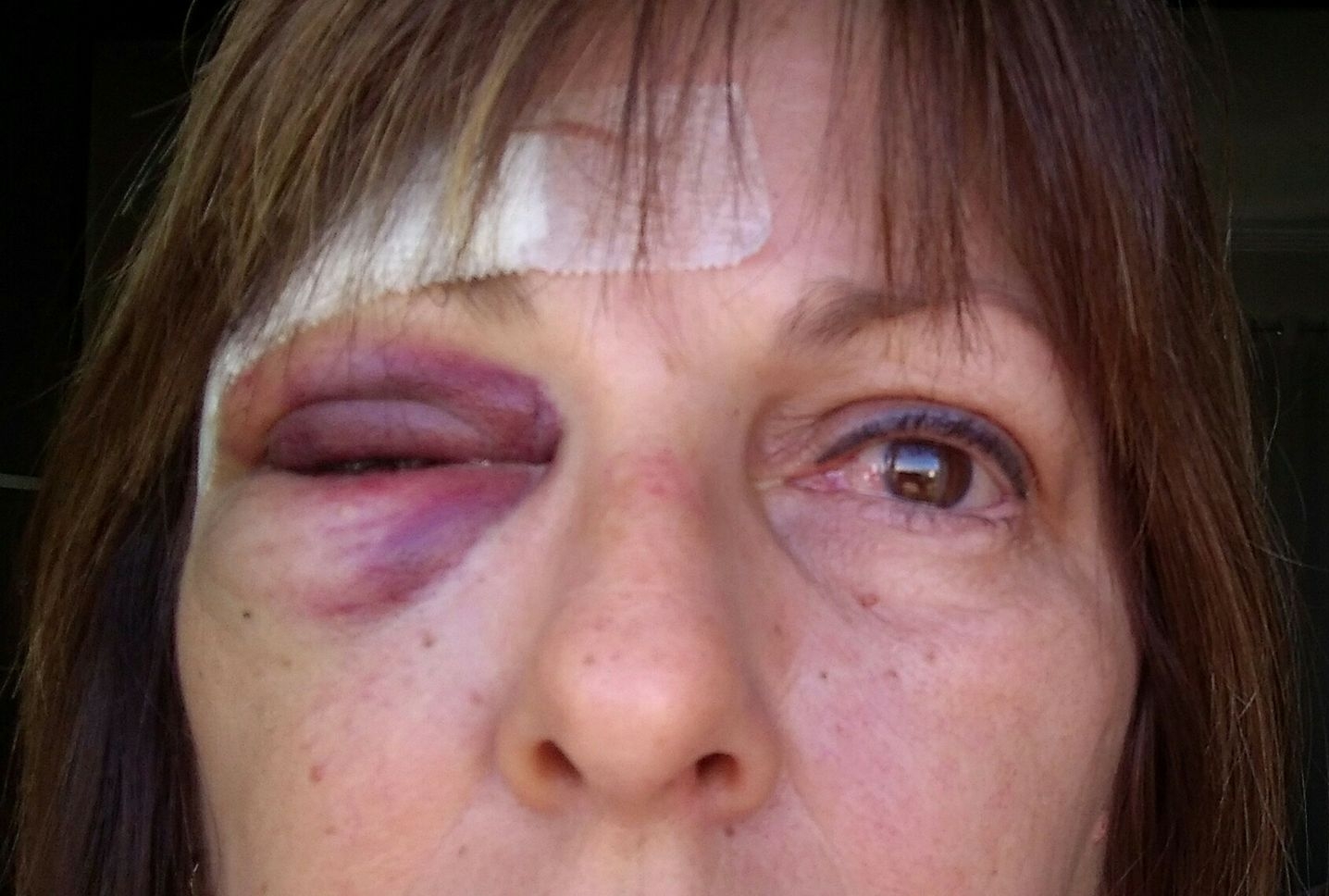 A professora Marcia Friggi ficou ferida após a agressão de um aluno de 15 anos - Reprodução/Facebook/ND