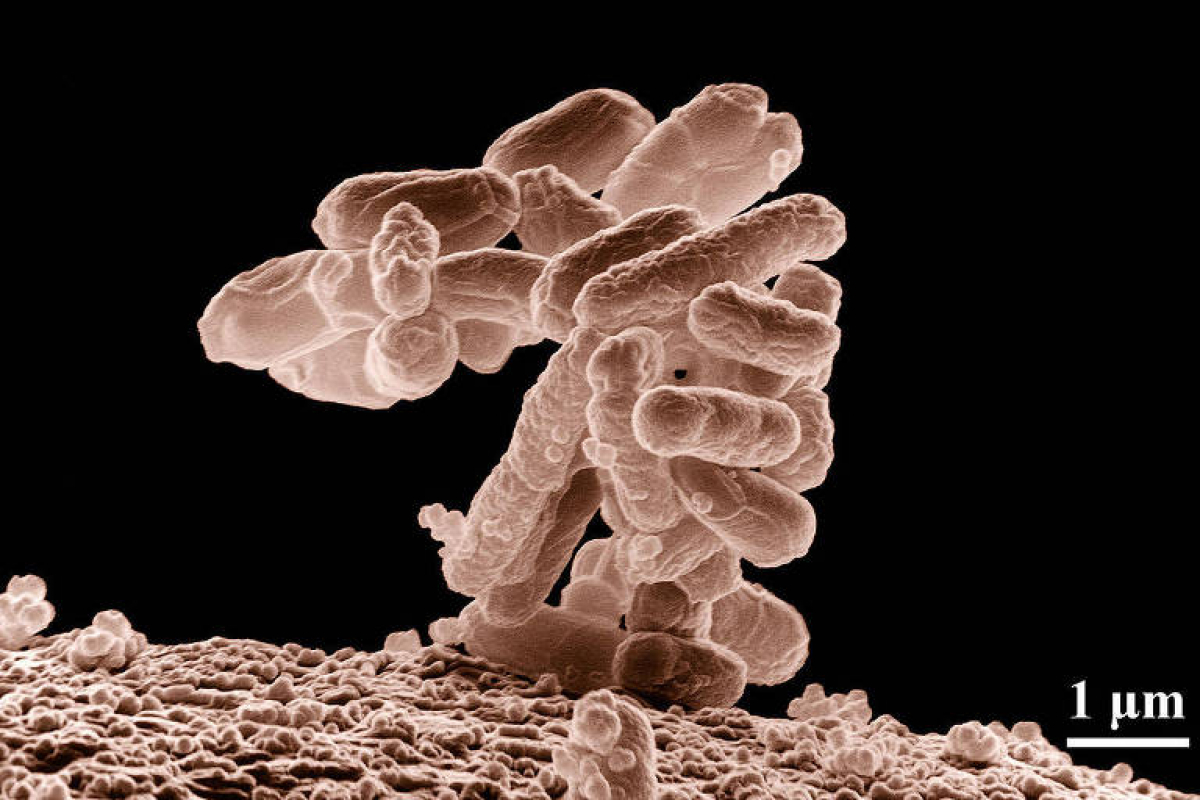 Imagem de bactérias e.  coli vista ao microscópio 