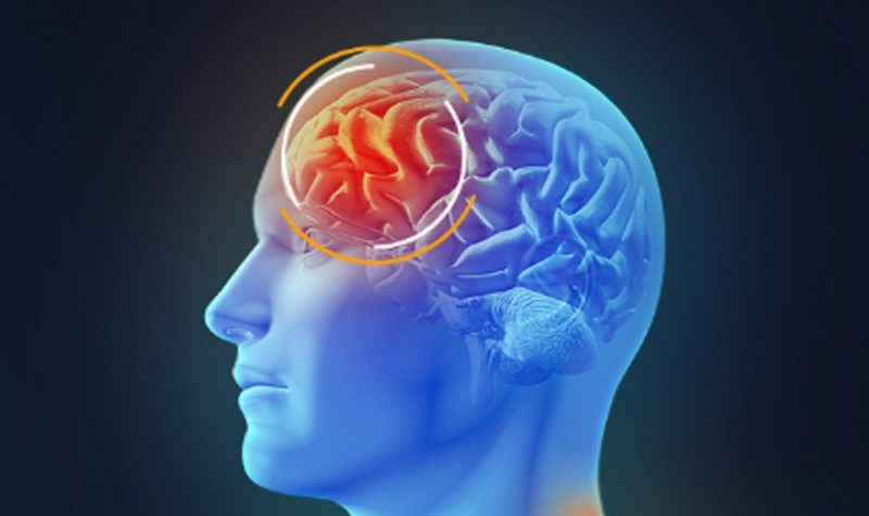 Diagnóstico do hematoma subdural pode ser feito através de uma tomografia computadorizada do cérebro ou de uma ressonância magnética 