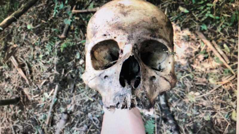 Crânio da vítima foi encontrado aproximadamente à 15 metros de distância do corpo – IGP-SC/Divulgação/ND
