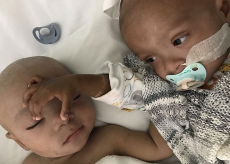 Os irm&atilde;os Emre e Eliha durante tratamento – Foto: Reprodu&ccedil;&atilde;o