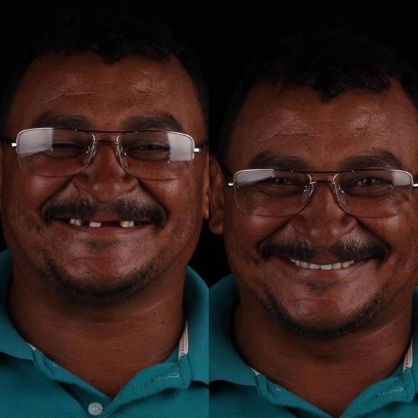 As atividades acontecem em locais cedidos pelos parceiros da organização ou pela prefeitura do município. - Reprodução/Instagram