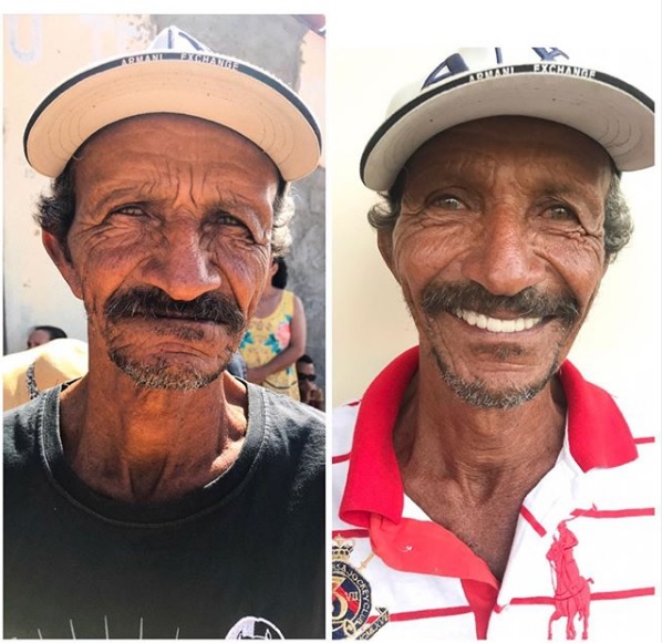 O atendimento segue padrões estabelecidos pela OMS (Organização Mundial de Saúde). Para realizar a cirurgia, a pessoa precisa estar em boas condição de saúde, que é avaliada pela equipe de triagem. Seu Manoel, de 65 anos, adorou o novo sorriso - Reprodução/Instagram