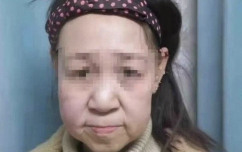 Adolescente tem 15 anos, mas apar&ecirc;ncia de 60 anos – Foto: Reprodu&ccedil;&atilde;o