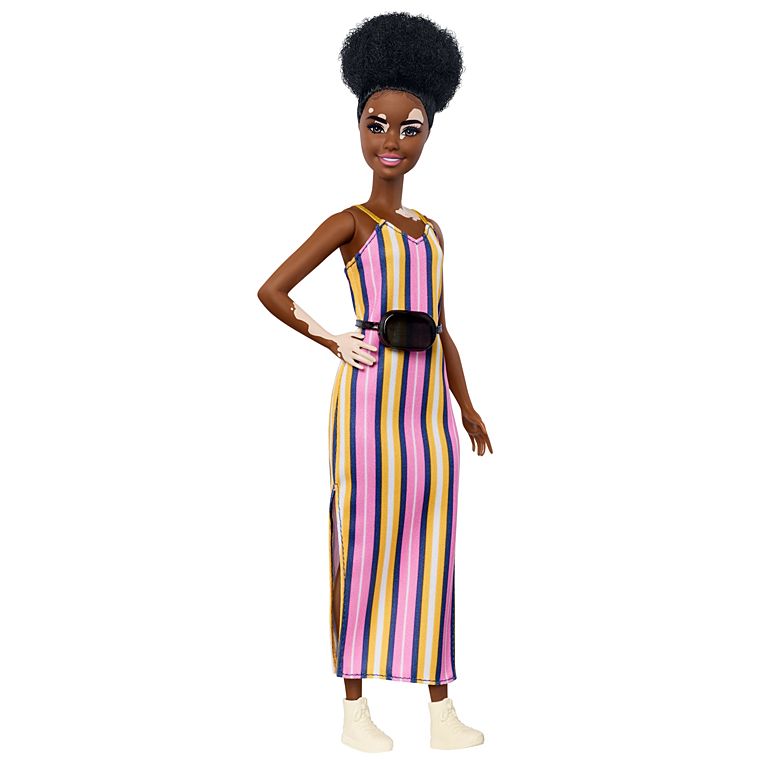 Barbie lançou boneca com vitiligo &#8211; Foto: Mattel/Divulgação/ND