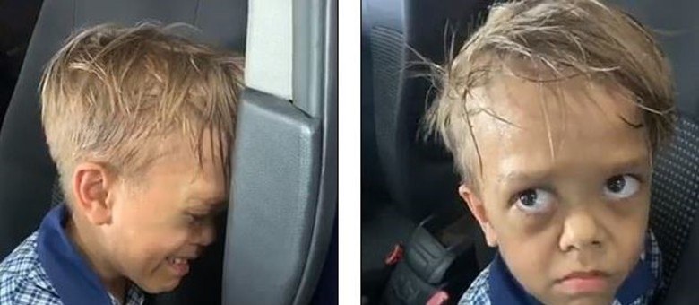 Quaiden Bayles, de 9 anos, sofre bullying dos colegas por ter nanismo – Foto: Reprodu&ccedil;&atilde;o/Facebook Yarraka Bayles