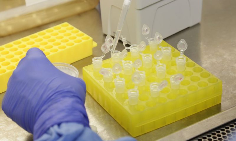 Estudo apontou teste positivo para novo coronavírus após pacientes terem alta – Foto: Divulgação/Josué Damacena (IOC/Fiocruz)/ND