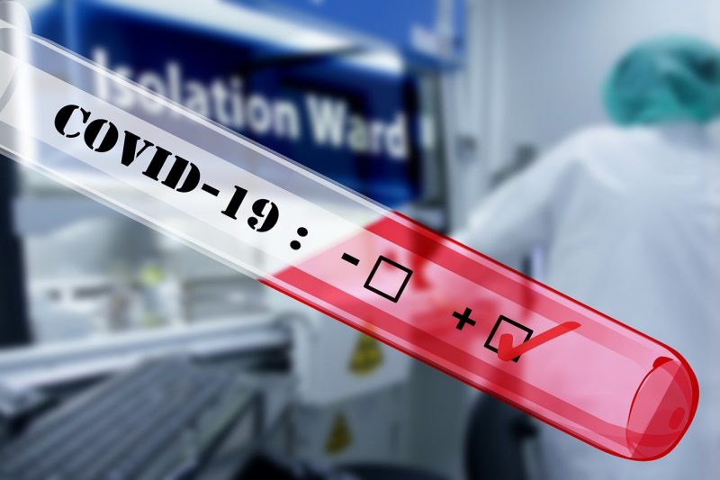 Maioria dos testes para infecção por coronavírus é feita no Lacen (Laboratório Central de Saúde Pública) – Foto: Pixabay/ND