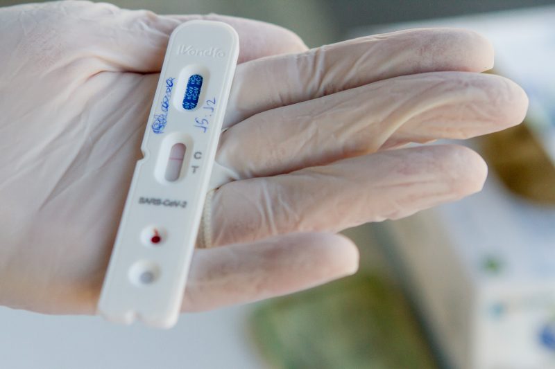 Comercialização de autotestes de Covid-19 está liberada no Brasil, diz Anvisa – Foto: Flavio Tin/Arquivo/ND