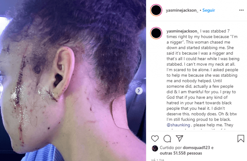 Yasmine Jackson diz que foi esfaqueada em atitude racista (Foto: Reprodu&ccedil;&atilde;o Instagram)