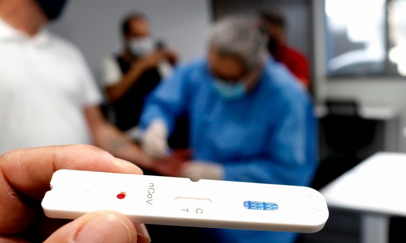 Alternativas&nbsp; e medicamentos para combater o novo coronav&iacute;rus – Foto: Mauricio Vieira/Secom/Divulga&ccedil;&atilde;o/ND