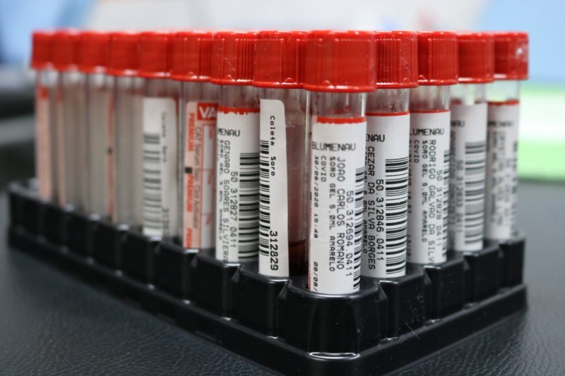 Todos os 19 atletas e membros da comiss&atilde;o t&eacute;cnica tiveram resultado negativo – Foto: Juliano Schmidt/JEC/Krona