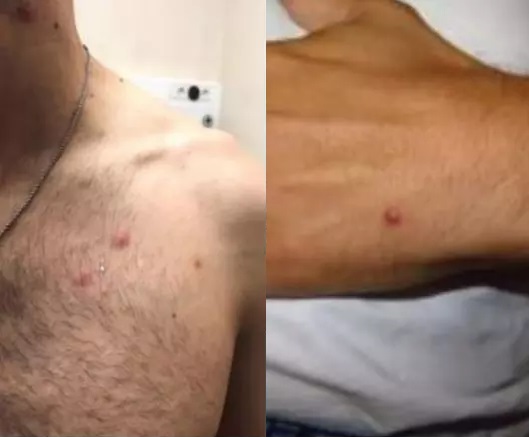 A recomenda&ccedil;&atilde;o da CDC inclui a recomenda&ccedil;&atilde;o de sexo virtual – Foto: Divulga&ccedil;&atilde;o/Unsplash/DIVE/SC/ND