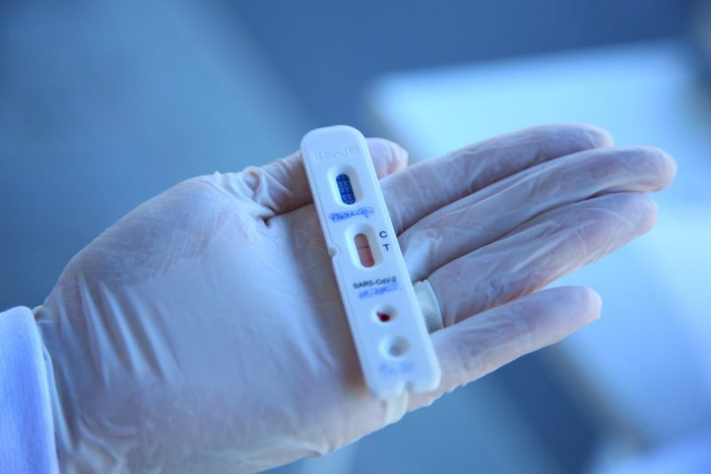 Cada exame diagn&oacute;stico da Covid-19 tem um per&iacute;odo espec&iacute;fico para ser feito e saber quando se submeter aos testes, e quais casos s&atilde;o recomendados para a realiza&ccedil;&atilde;o destes exames &eacute; fundamental para a obten&ccedil;&atilde;o do diagn&oacute;stico correto – Leonardo Sousa/PMF/Divulga&ccedil;&atilde;o/ND