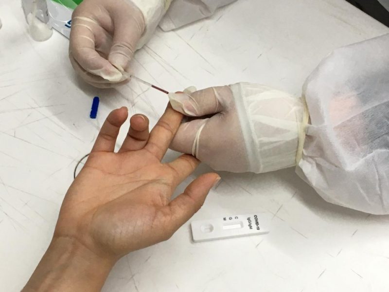 Procon aponta pr&aacute;tica de pre&ccedil;o abusivo em testes de coronav&iacute;rus – Foto: PMB/Divulga&ccedil;&atilde;o/ND