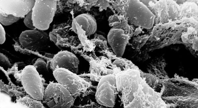 Bact&eacute;ria que causa a peste bub&ocirc;nica &eacute; a Yersinia-pestis – Foto: wikipedia