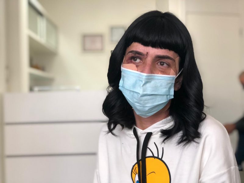 Alice Felis, modelo trans ferida em agress&atilde;o no Rio de Janeiro, passa por cirurgia em Blumenau – Foto: Gabriela Milanezi/NDTV