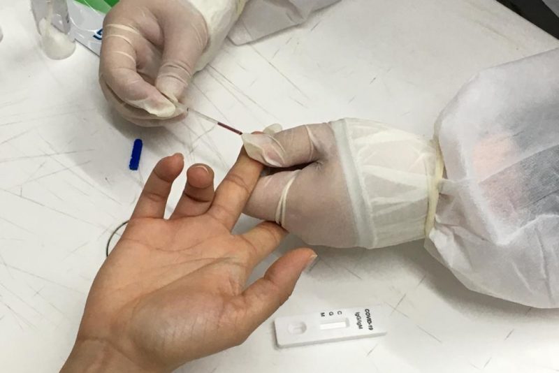 Blumenau registra 44 de coronav&iacute;rus nas &uacute;ltimas 24 horas – Foto: Jo&atilde;o Vitor Korc / Prefeitura de Blumenau