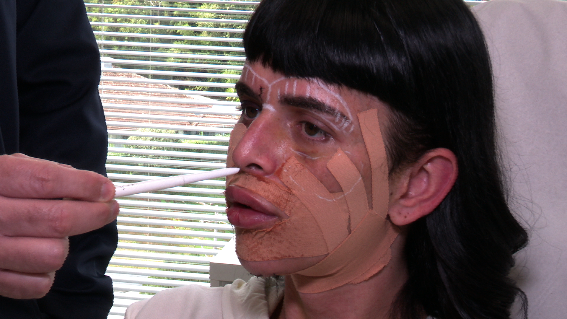 Feminização facial é cirurgia mais procurada por pacientes
