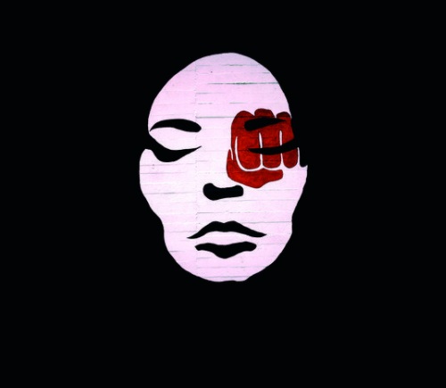 Sequelas acompanham a mulher at&eacute; hoje&nbsp; – Foto: Divulga&ccedil;&atilde;o/ND