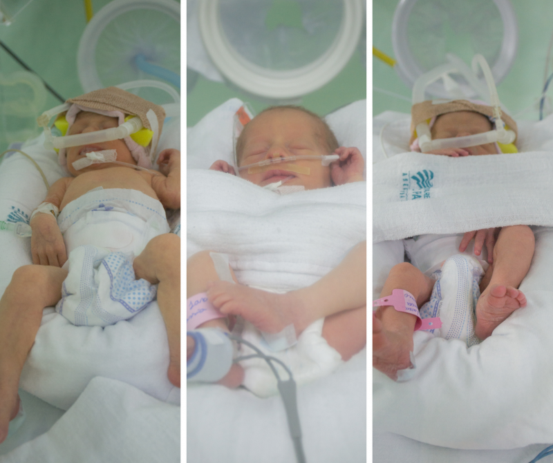 Marta, Milena e Marielli nasceram na ter&ccedil;a-feira (15), em Xanxer&ecirc; – Foto: Cristine Maraga/HRSP