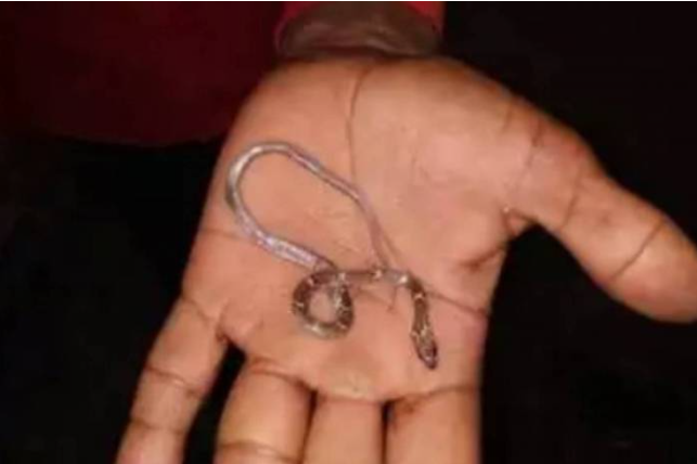 Crian&ccedil;a engole cobra venenosa e &eacute; levada para o hospital – Foto: Times Of India