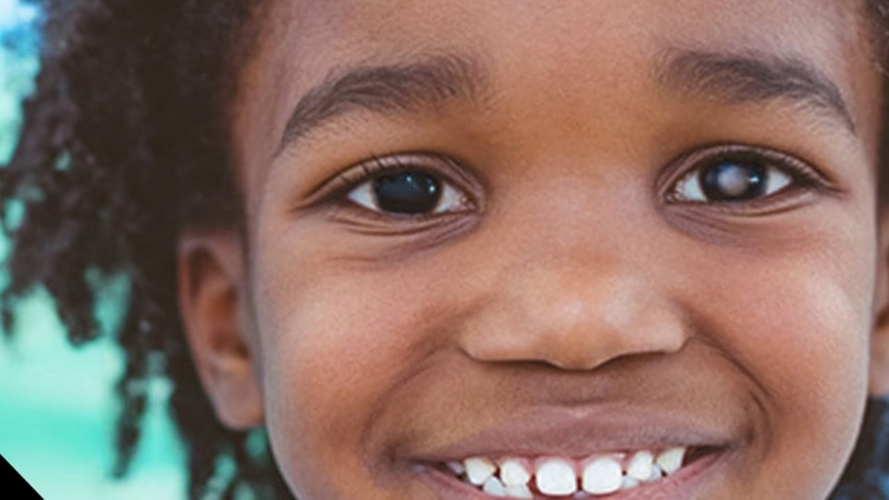 Retinoblastoma, um câncer raro que pode ocorrer nos olhos das crianças -  Blog Saúde Infantil