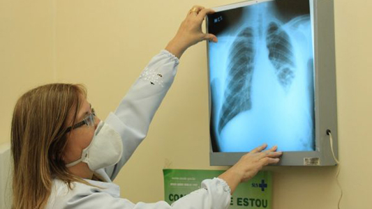 Médicos recomendam &#8220;ventilação protetora&#8221; para amenizar lesões nos pulmões dos pacientes com Covid-19  &#8211; Foto: Divulgação Fiocruz/ND