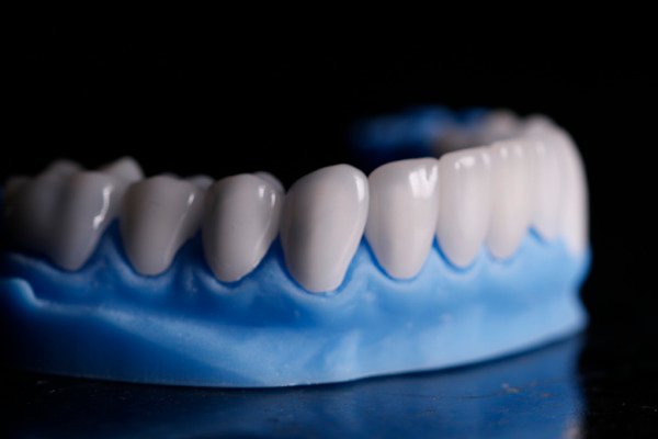 Queda de dentes foi apontada com uma das sequelas em alguns pacientes – Foto: Divulga&ccedil;&atilde;o/CIR