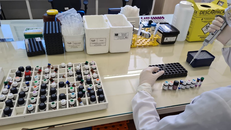 Pesquisa pode contribuir para o estabelecimento de pol&iacute;ticas p&uacute;blicas de sa&uacute;de relacionadas &agrave; Covid-19 – Foto: Sinval Paulino