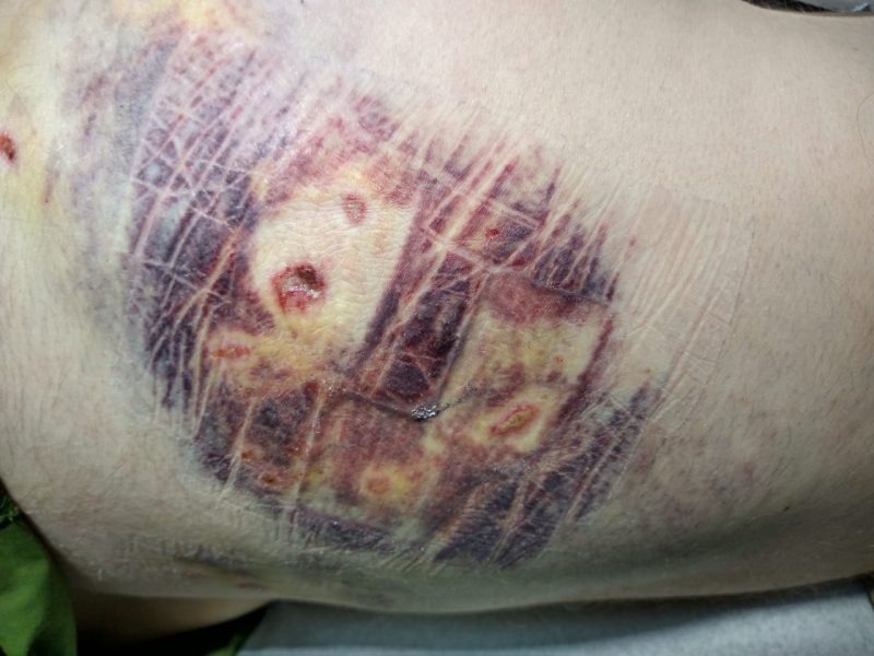Hugo Golin sofreu diversos ferimentos ao ser atacado por cão em Parque de Criciúma &#8211; Foto: Divulgação