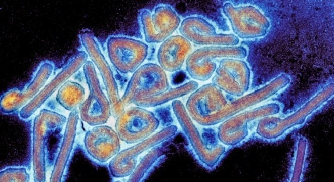 Vírus mortal encontrado na Bolívia é transmissível entre humanos – Foto: Reprodução/Omics