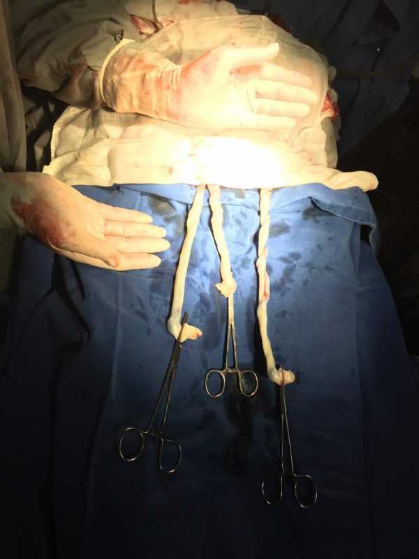 Ambos os três permanecem em cuidados, na UTI do hospital – Foto: Divulgação/SES/ND