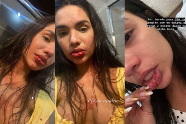 Influecer Kedma Oliveira, de 27 anos, acusou o filho do namorado de agressão – Foto: Reprodução/ND