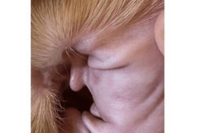 A estranha imagem de Donald Trump de perfil vem ganhando repercuss&atilde;o. – Foto: Reprodu&ccedil;&atilde;o Reddit