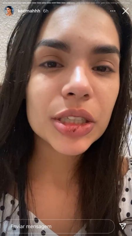 Kedma Oliveira disse que “n&atilde;o ia se calar” em v&iacute;deo postado nesta segunda-feira – Foto: Reprodu&ccedil;&atilde;o/Redes Sociais/ND