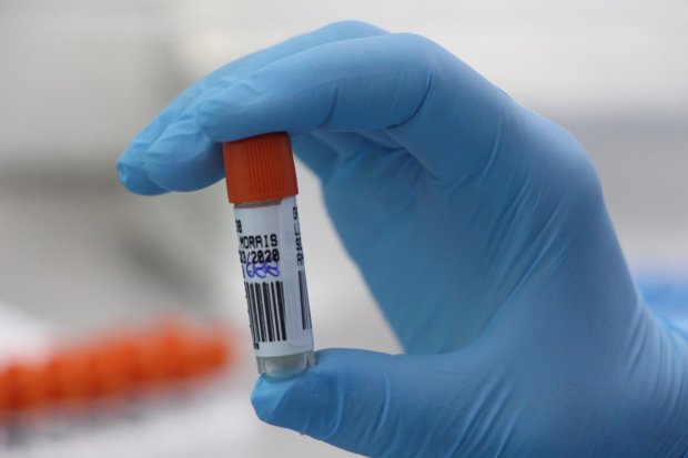 Lacen fez mais de 400 mil testes de covid-19 em SC