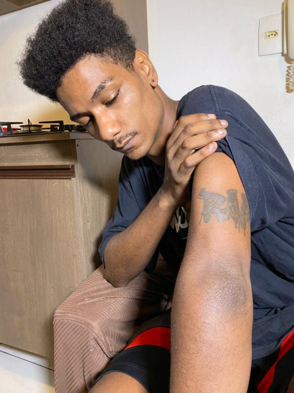 Raphael Guilherme mostra marcas da agress&atilde;o que sofreu – Foto: Mois&eacute;s Stucker/NDTV