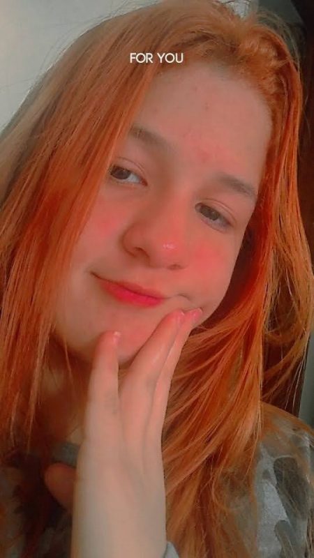 Rebeca Sayuri Albuquerque Minori, de 15 anos, ficou em estado grave após o atropelamento – Foto: Arquivo Pessoal