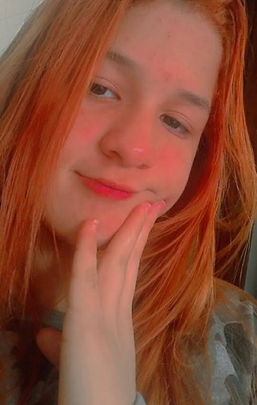 Rebeca Sayuri Albuquerque Minori, de 15 anos, ficou em estado grave após o atropelamento – Foto: Arquivo Pessoal