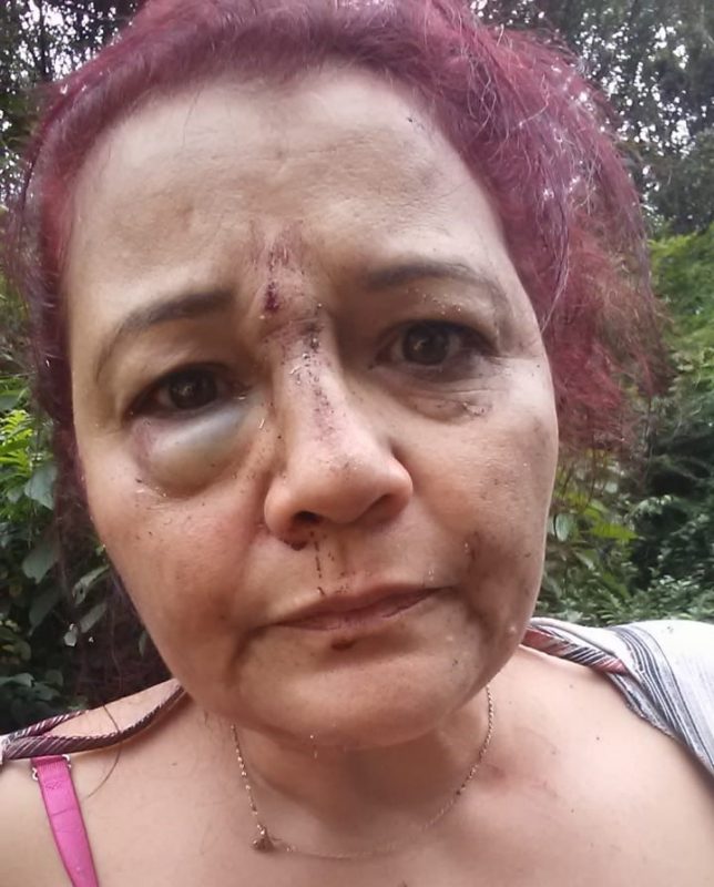 Andr&eacute;a mandou a foto para o filho pouco depois do acidente – Foto: Arquivo Pessoal