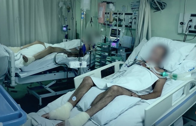 A região de Chapecó foi a primeira a dar indícios do colapso do sistema público de saúde. Na transição de fevereiro para março, SC passou a somar uma lotação acima de 90% e atualmente soma uma fila de pacientes – Foto: HRSP/Divulgação/ND