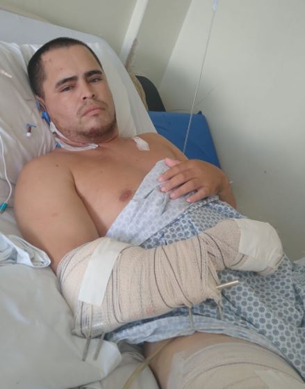 Altevir Alves de Lima, de 30 anos, ficou gravemente ferido ap&oacute;s acidente – Foto: Arquivo Pessoal