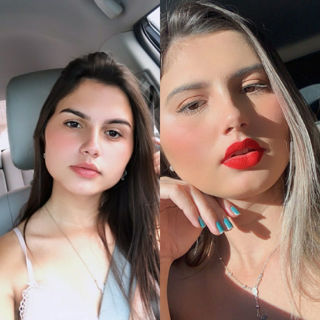 Transexual operada