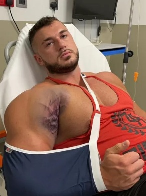Fisiculturista britânico Ryan Crowley, de 23 anos, fez um longo desabafo sobre a grave lesão no músculo que viralizou nas redes sociais – Foto: Instagram/Reprodução/ND