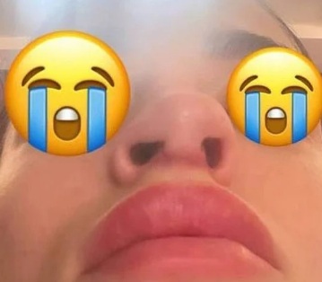 Influencer tenta financiar nova cirurgia – Foto: Instagram/Reprodu&ccedil;&atilde;o/ND