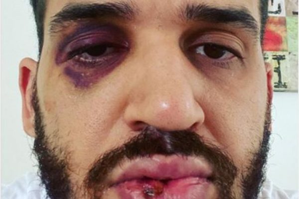 M&eacute;dico levou surra ap&oacute;s alertar sobre algomera&ccedil;&otilde;es e Covid-19 – Foto: Divulga&ccedil;&atilde;o