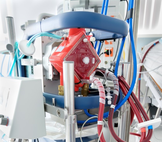 Aparelho de ECMO, cuja terapia foi usada, por exemplo, pelo ator Paulo Gustavo – Foto: CRBM/Divulga&ccedil;&atilde;o/ND