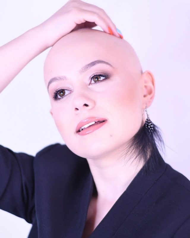 “Cansei um pouco das perucas e de tudo que elas trazem, muita atenção e estresse desnecessário. Sou aliviada porque a alopecia não é algo que pode tirar a minha vida”, disse, em entrevista ao site Bored Panda. “Não há nada mais bonito do que quando você se aceita como é”, acrescentou – Foto: Reprodução/Instagram