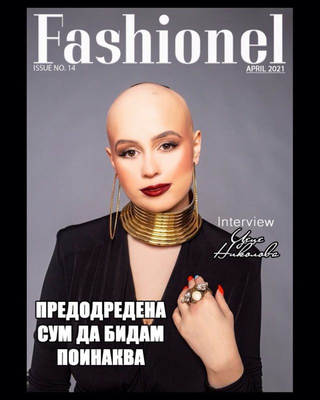 Após revelar sua calvície, ela se tornou capa da edição de abril da revista de moda Fashionel, publicada na Macedônia, seu país – Foto: Reprodução/Instagram/ND